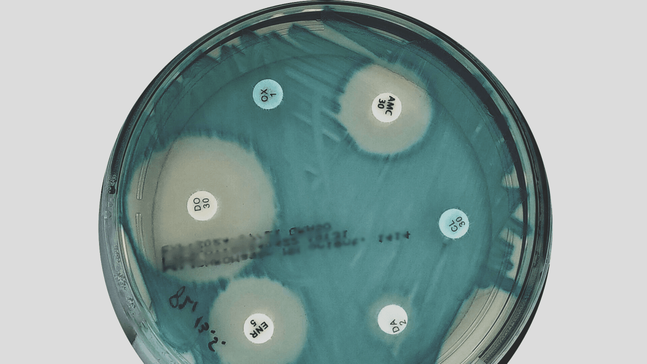 Antibiogram plate showing zones of inhibition