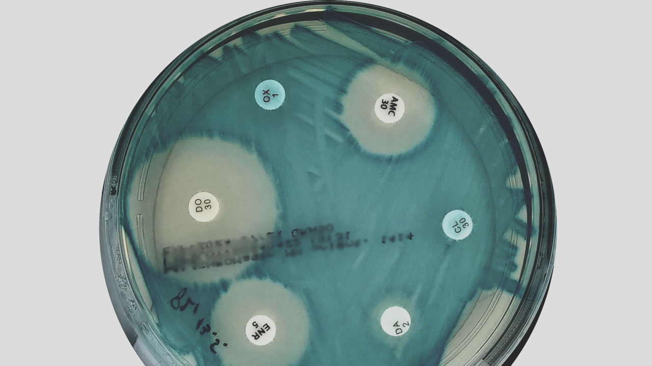 Antibiogram plate showing zones of inhibition